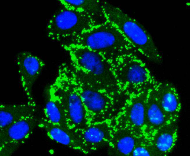 ICC staining pro Caspase 7 in HepG2 cells (green). The nuclear counter stain is DAPI (blue). Cells were fixed in paraformaldehyde, permeabilised with 0.25% Triton X100/PBS.