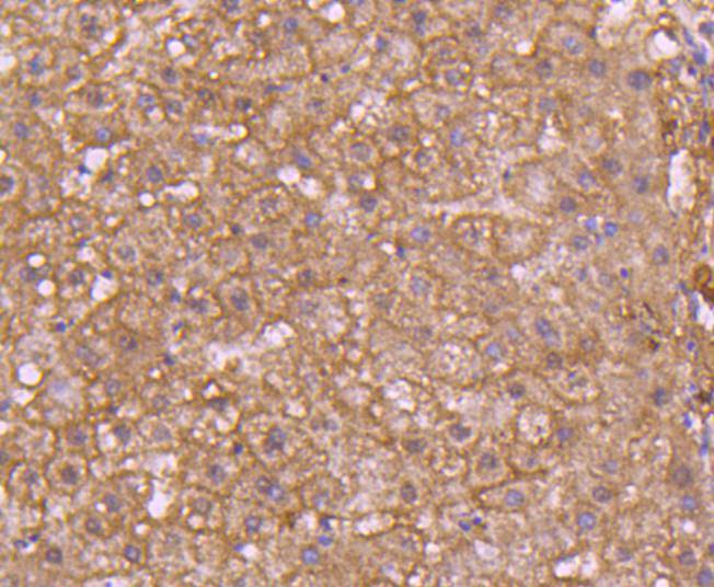 Immunohistochemical analysis of paraffin-embedded human liver tissue using anti-pro Caspase 7 antibody. Counter stained with hematoxylin.