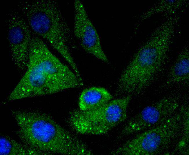 ICC staining of Caspase-5 in SHG-44 cells (green). Formalin fixed cells were permeabilized with 0.1% Triton X-100 in TBS for 10 minutes at room temperature and blocked with 10% negative goat serum for 15 minutes at room temperature. Cells were probed with the primary antibody (ET1612-29, 1/50) for 1 hour at room temperature, washed with PBS. Alexa Fluor®488 conjugate-Goat anti-Rabbit IgG was used as the secondary antibody at 1/1,000 dilution. The nuclear counter stain is DAPI (blue).