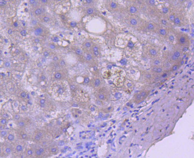 Immunohistochemical analysis of paraffin-embedded human liver tissue using anti-Caspase-5 antibody. The section was pre-treated using heat mediated antigen retrieval with Tris-EDTA buffer (pH 9.0) for 20 minutes.The tissues were blocked in 1% BSA for 30 minutes at room temperature, washed with ddH2O and PBS, and then probed with the primary antibody (ET1612-29, 1/50) for 30 minutes at room temperature. The detection was performed using an HRP conjugated compact polymer system. DAB was used as the chromogen. Tissues were counterstained with hematoxylin and mounted with DPX.