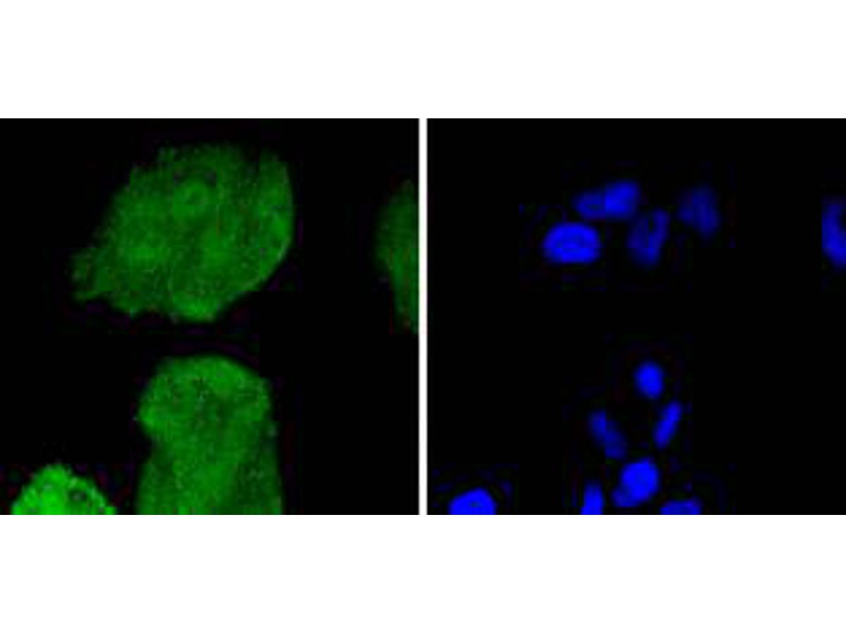 ICC staining of Cdk6 in Hela cells (green). Formalin fixed cells were permeabilized with 0.1% Triton X-100 in TBS for 10 minutes at room temperature and blocked with 1% Blocker BSA for 15 minutes at room temperature. Cells were probed with the primary antibody (ET1612-3, 1/50) for 1 hour at room temperature, washed with PBS. Alexa Fluor®488 Goat anti-Rabbit IgG was used as the secondary antibody at 1/1,000 dilution. The nuclear counter stain is DAPI (blue).