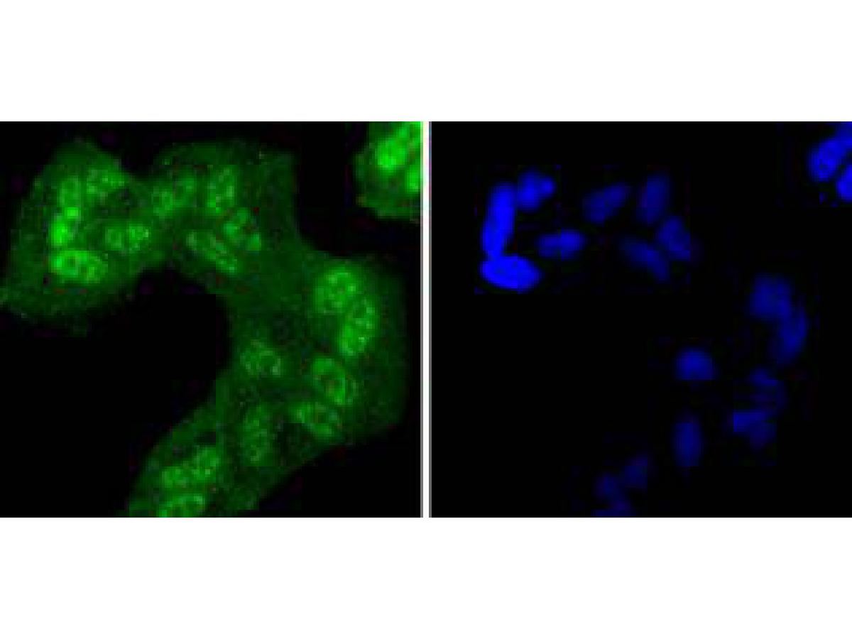 ICC staining of Phospho-EGFR(Y1068) in Hela cells (green). Formalin fixed cells were permeabilized with 0.1% Triton X-100 in TBS for 10 minutes at room temperature and blocked with 1% Blocker BSA for 15 minutes at room temperature. Cells were probed with the primary antibody (ET1612-30, 1/50) for 1 hour at room temperature, washed with PBS. Alexa Fluor®488 Goat anti-Rabbit IgG was used as the secondary antibody at 1/1,000 dilution. The nuclear counter stain is DAPI (blue).