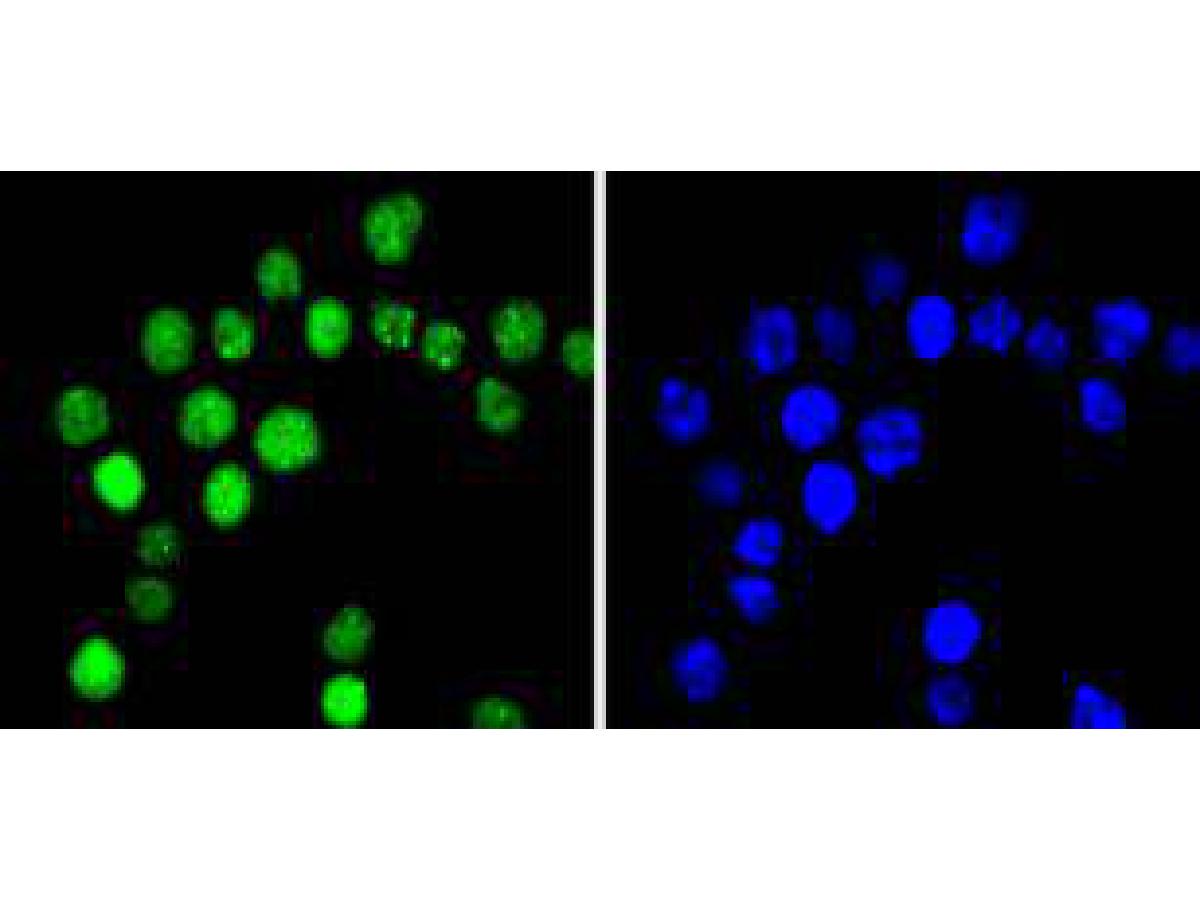 ICC staining of Phospho-Cyclin E1(T77) in SW480 cells (green). Formalin fixed cells were permeabilized with 0.1% Triton X-100 in TBS for 10 minutes at room temperature and blocked with 1% Blocker BSA for 15 minutes at room temperature. Cells were probed with the primary antibody (ET1612-31, 1/50) for 1 hour at room temperature, washed with PBS. Alexa Fluor®488 Goat anti-Rabbit IgG was used as the secondary antibody at 1/1,000 dilution. The nuclear counter stain is DAPI (blue).