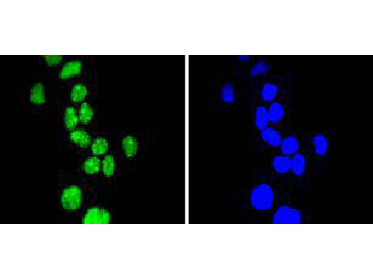 ICC staining of Phospho-Cyclin E1(T77) in Hela cells (green). Formalin fixed cells were permeabilized with 0.1% Triton X-100 in TBS for 10 minutes at room temperature and blocked with 1% Blocker BSA for 15 minutes at room temperature. Cells were probed with the primary antibody (ET1612-31, 1/50) for 1 hour at room temperature, washed with PBS. Alexa Fluor®488 Goat anti-Rabbit IgG was used as the secondary antibody at 1/1,000 dilution. The nuclear counter stain is DAPI (blue).