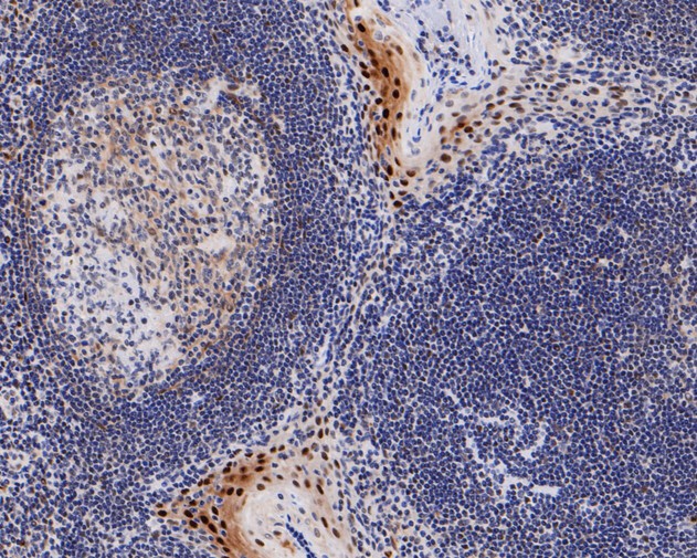 Immunohistochemical analysis of paraffin-embedded human tonsil tissue using anti-Phospho-Cyclin E1(T77) antibody. The section was pre-treated using heat mediated antigen retrieval with sodium citrate buffer (pH 6.0) for 20 minutes. The tissues were blocked in 5% BSA for 30 minutes at room temperature, washed with ddH2O and PBS, and then probed with the primary antibody (ET1612-31, 1/50)  for 30 minutes at room temperature. The detection was performed using an HRP conjugated compact polymer system. DAB was used as the chromogen. Tissues were counterstained with hematoxylin and mounted with DPX.