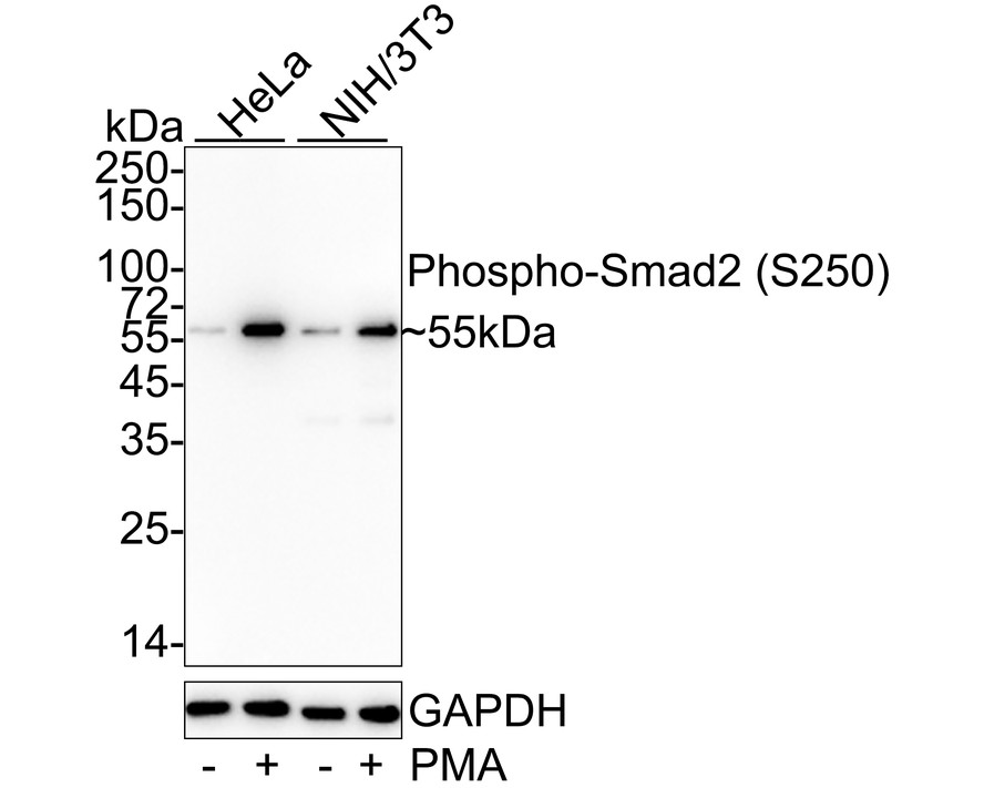 Western blot analysis of Phospho-Smad2 (S250) on different lysates. Proteins were transferred to a PVDF membrane and blocked with 5% BSA in PBS for 1 hour at room temperature. The primary antibody (ET1612-32, 1/500) was used in 5% BSA at room temperature for 2 hours. Goat Anti-Rabbit IgG - HRP Secondary Antibody (HA1001) at 1:5,000 dilution was used for 1 hour at room temperature.<br />
Positive control: <br />
Lane 1: human placenta tissue lysate<br />
Lane 1: human kidney tissue lysate<br />
Lane 2: SiHa cell lysate