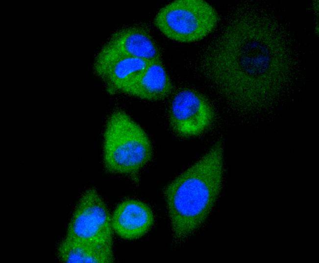 ICC staining of AP2M1 in MCF-7 cells (green). Formalin fixed cells were permeabilized with 0.1% Triton X-100 in TBS for 10 minutes at room temperature and blocked with 1% Blocker BSA for 15 minutes at room temperature. Cells were probed with the primary antibody (ET1612-33, 1/50) for 1 hour at room temperature, washed with PBS. Alexa Fluor®488 Goat anti-Rabbit IgG was used as the secondary antibody at 1/1,000 dilution. The nuclear counter stain is DAPI (blue).