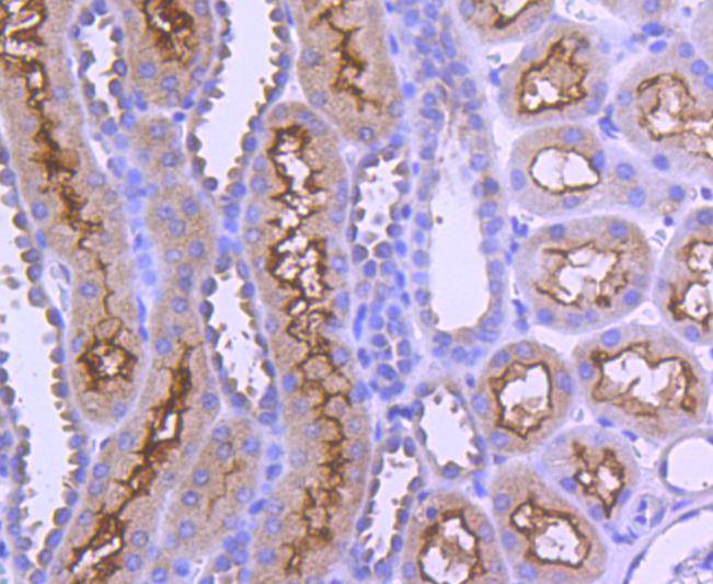 Immunohistochemical analysis of paraffin-embedded human kidney tissue using anti-AP2M1 antibody. The section was pre-treated using heat mediated antigen retrieval with Tris-EDTA buffer (pH 8.0-8.4) for 20 minutes.The tissues were blocked in 5% BSA for 30 minutes at room temperature, washed with ddH2O and PBS, and then probed with the primary antibody (ET1612-33, 1/50) for 30 minutes at room temperature. The detection was performed using an HRP conjugated compact polymer system. DAB was used as the chromogen. Tissues were counterstained with hematoxylin and mounted with DPX.