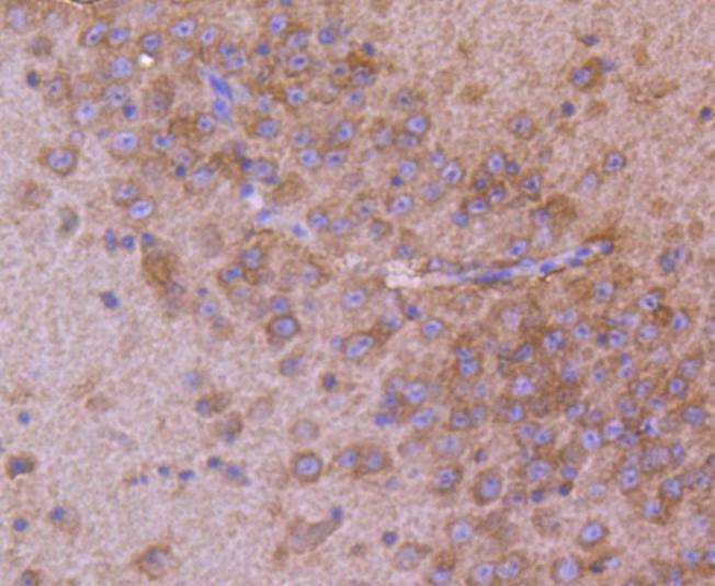 Immunohistochemical analysis of paraffin-embedded mouse brain tissue using anti-AP2M1 antibody. The section was pre-treated using heat mediated antigen retrieval with Tris-EDTA buffer (pH 8.0-8.4) for 20 minutes.The tissues were blocked in 5% BSA for 30 minutes at room temperature, washed with ddH2O and PBS, and then probed with the primary antibody (ET1612-33, 1/50) for 30 minutes at room temperature. The detection was performed using an HRP conjugated compact polymer system. DAB was used as the chromogen. Tissues were counterstained with hematoxylin and mounted with DPX.