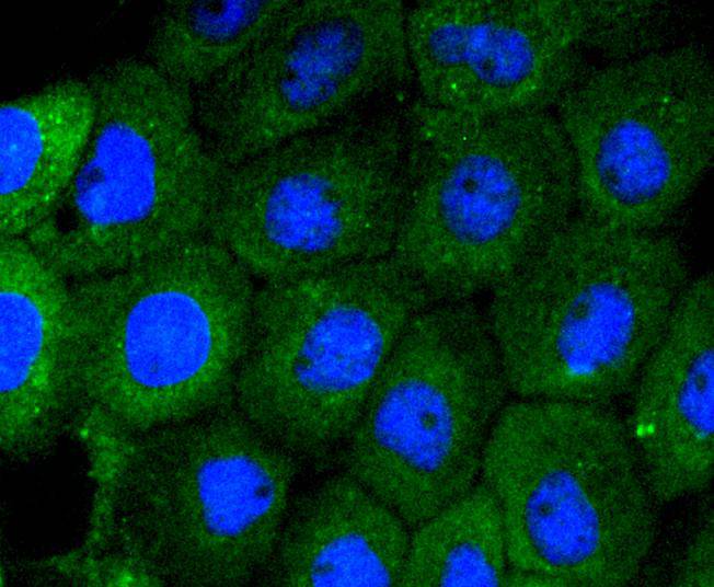 ICC staining of MEK5 in A431 cells (green). Formalin fixed cells were permeabilized with 0.1% Triton X-100 in TBS for 10 minutes at room temperature and blocked with 1% Blocker BSA for 15 minutes at room temperature. Cells were probed with the primary antibody (ET1612-34, 1/50) for 1 hour at room temperature, washed with PBS. Alexa Fluor®488 Goat anti-Rabbit IgG was used as the secondary antibody at 1/1,000 dilution. The nuclear counter stain is DAPI (blue).