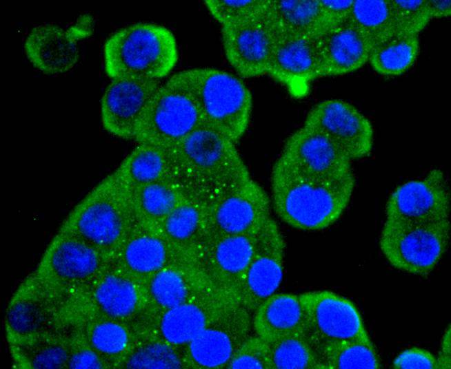 ICC staining of MEK5 in SW480 cells (green). Formalin fixed cells were permeabilized with 0.1% Triton X-100 in TBS for 10 minutes at room temperature and blocked with 1% Blocker BSA for 15 minutes at room temperature. Cells were probed with the primary antibody (ET1612-34, 1/50) for 1 hour at room temperature, washed with PBS. Alexa Fluor®488 Goat anti-Rabbit IgG was used as the secondary antibody at 1/1,000 dilution. The nuclear counter stain is DAPI (blue).