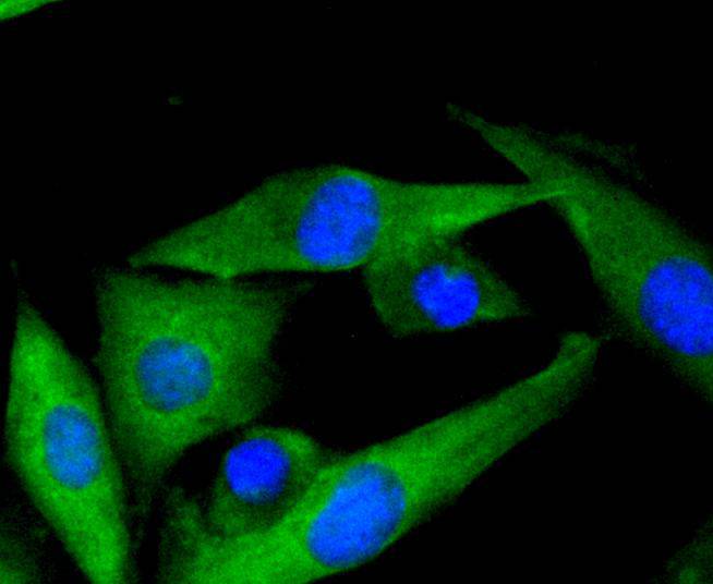 ICC staining MEK7 in SH-SY-5Y cells (green). The nuclear counter stain is DAPI (blue). Cells were fixed in paraformaldehyde, permeabilised with 0.25% Triton X100/PBS.