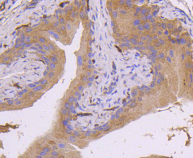 Immunohistochemical analysis of paraffin-embedded rat brain tissue using anti-MEK7 antibody. Counter stained with hematoxylin.