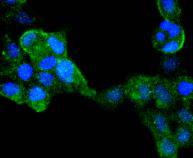 ICC staining IRF6 in 293 cells (green). The nuclear counter stain is DAPI (blue). Cells were fixed in paraformaldehyde, permeabilised with 0.25% Triton X100/PBS.