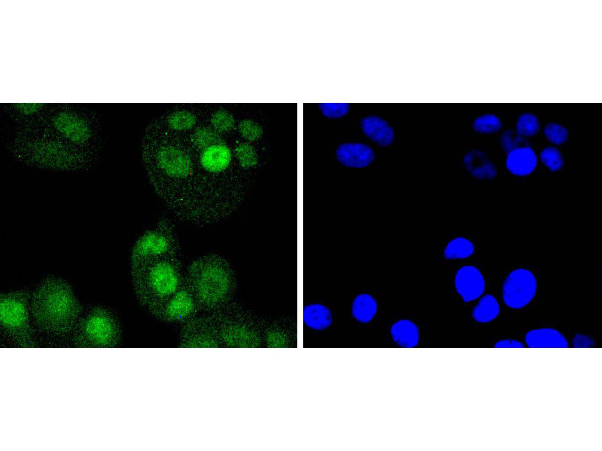 ICC staining IRF6 in MCF-7 cells (green). The nuclear counter stain is DAPI (blue). Cells were fixed in paraformaldehyde, permeabilised with 0.25% Triton X100/PBS.