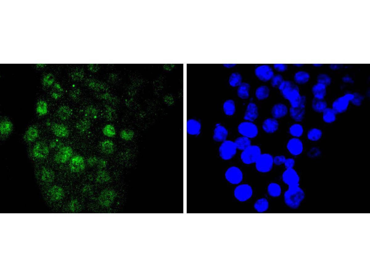ICC staining IRF6 in SW480 cells (green). The nuclear counter stain is DAPI (blue). Cells were fixed in paraformaldehyde, permeabilised with 0.25% Triton X100/PBS.