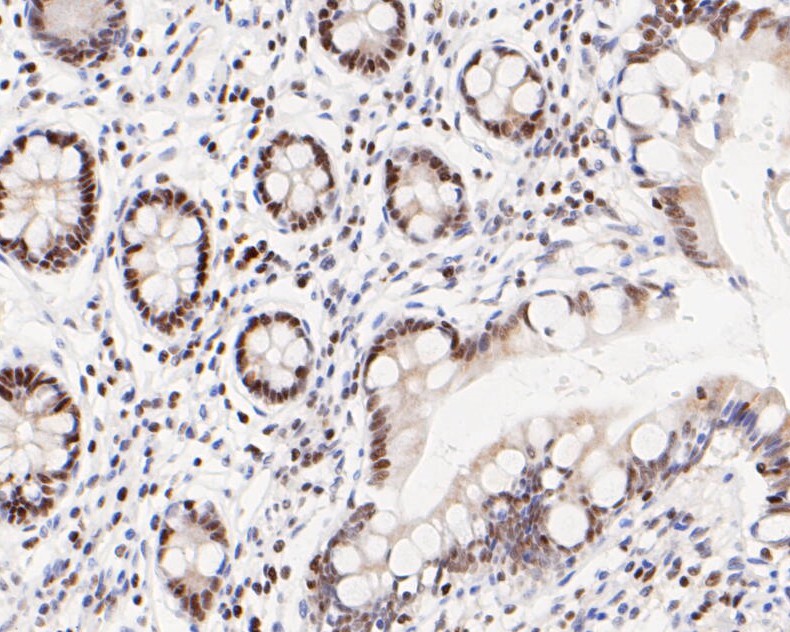 Immunohistochemical analysis of paraffin-embedded human small intestine tissue using anti-ATF4 antibody. The section was pre-treated using heat mediated antigen retrieval with sodium citrate buffer (pH 6.0) for 20 minutes. The tissues were blocked in 5% BSA for 30 minutes at room temperature, washed with ddH2O and PBS, and then probed with the primary antibody (ET1612-37, 1/50)  for 30 minutes at room temperature. The detection was performed using an HRP conjugated compact polymer system. DAB was used as the chromogen. Tissues were counterstained with hematoxylin and mounted with DPX.
