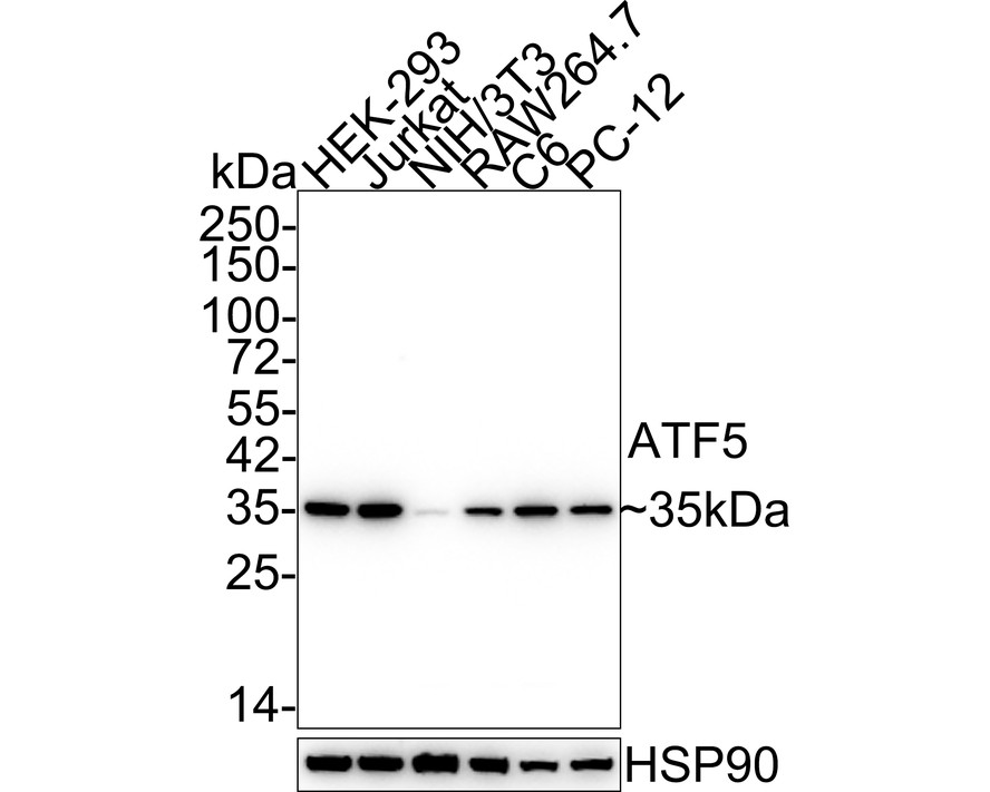 Western blot analysis of ATF5 on different lysates with Rabbit anti-ATF5 antibody (ET1612-38) at 1/500 dilution.<br />
<br />
Lane 1: Jurkat cell lysate<br />
Lane 2: PC-12 cell lysate<br />
<br />
Lysates/proteins at 10 µg/Lane.<br />
<br />
Predicted band size: 92 kDa<br />
Observed band size: 92 kDa<br />
<br />
Exposure time: 1 minute;<br />
<br />
12% SDS-PAGE gel.<br />
<br />
Proteins were transferred to a PVDF membrane and blocked with 5% NFDM/TBST for 1 hour at room temperature. The primary antibody (ET1612-38) at 1/500 dilution was used in 5% NFDM/TBST at room temperature for 2 hours. Goat Anti-Rabbit IgG - HRP Secondary Antibody (HA1001) at 1:300,000 dilution was used for 1 hour at room temperature.