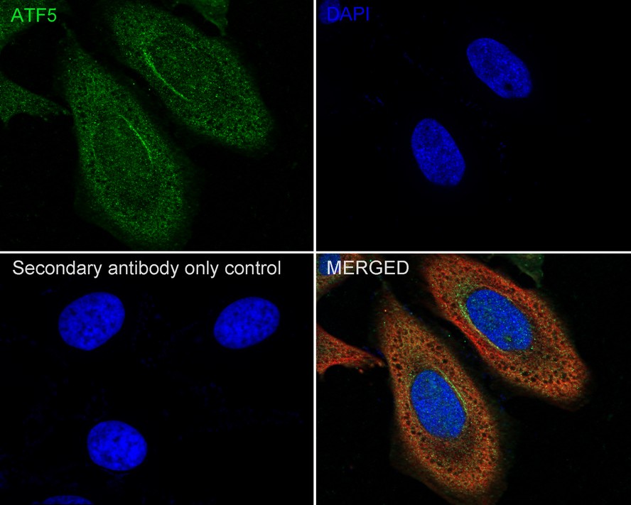 ICC staining of ATF5 in Hela cells (green). Formalin fixed cells were permeabilized with 0.1% Triton X-100 in TBS for 10 minutes at room temperature and blocked with 1% Blocker BSA for 15 minutes at room temperature. Cells were probed with the primary antibody (ET1612-38, 1/50) for 1 hour at room temperature, washed with PBS. Alexa Fluor®488 Goat anti-Rabbit IgG was used as the secondary antibody at 1/1,000 dilution. The nuclear counter stain is DAPI (blue).