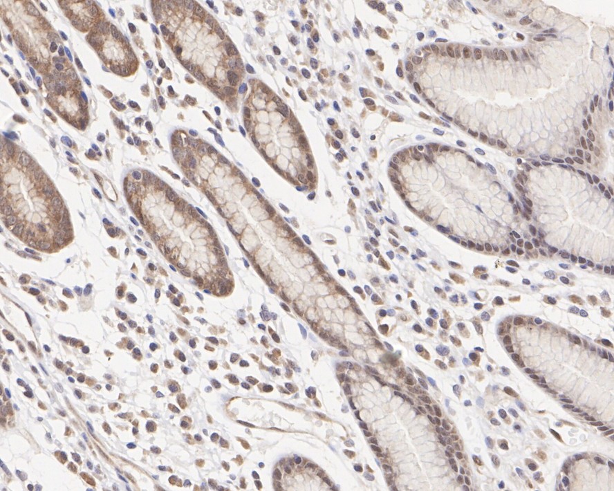 Immunohistochemical analysis of paraffin-embedded mouse heart tissue using anti-ATF5 antibody. The section was pre-treated using heat mediated antigen retrieval with Tris-EDTA buffer (pH 8.0-8.4) for 20 minutes.The tissues were blocked in 5% BSA for 30 minutes at room temperature, washed with ddH2O and PBS, and then probed with the primary antibody (ET1612-38, 1/50) for 30 minutes at room temperature. The detection was performed using an HRP conjugated compact polymer system. DAB was used as the chromogen. Tissues were counterstained with hematoxylin and mounted with DPX.