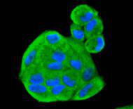 ICC staining of Smad1 in Hela cells (green). Formalin fixed cells were permeabilized with 0.1% Triton X-100 in TBS for 10 minutes at room temperature and blocked with 10% negative goat serum for 15 minutes at room temperature. Cells were probed with the primary antibody (ET1612-39, 1/50) for 1 hour at room temperature, washed with PBS. Alexa Fluor®488 conjugate-Goat anti-Rabbit IgG was used as the secondary antibody at 1/1,000 dilution. The nuclear counter stain is DAPI (blue).