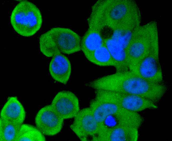 ICC staining of Smad1 in MCF-7 cells (green). Formalin fixed cells were permeabilized with 0.1% Triton X-100 in TBS for 10 minutes at room temperature and blocked with 10% negative goat serum for 15 minutes at room temperature. Cells were probed with the primary antibody (ET1612-39, 1/50) for 1 hour at room temperature, washed with PBS. Alexa Fluor®488 conjugate-Goat anti-Rabbit IgG was used as the secondary antibody at 1/1,000 dilution. The nuclear counter stain is DAPI (blue).