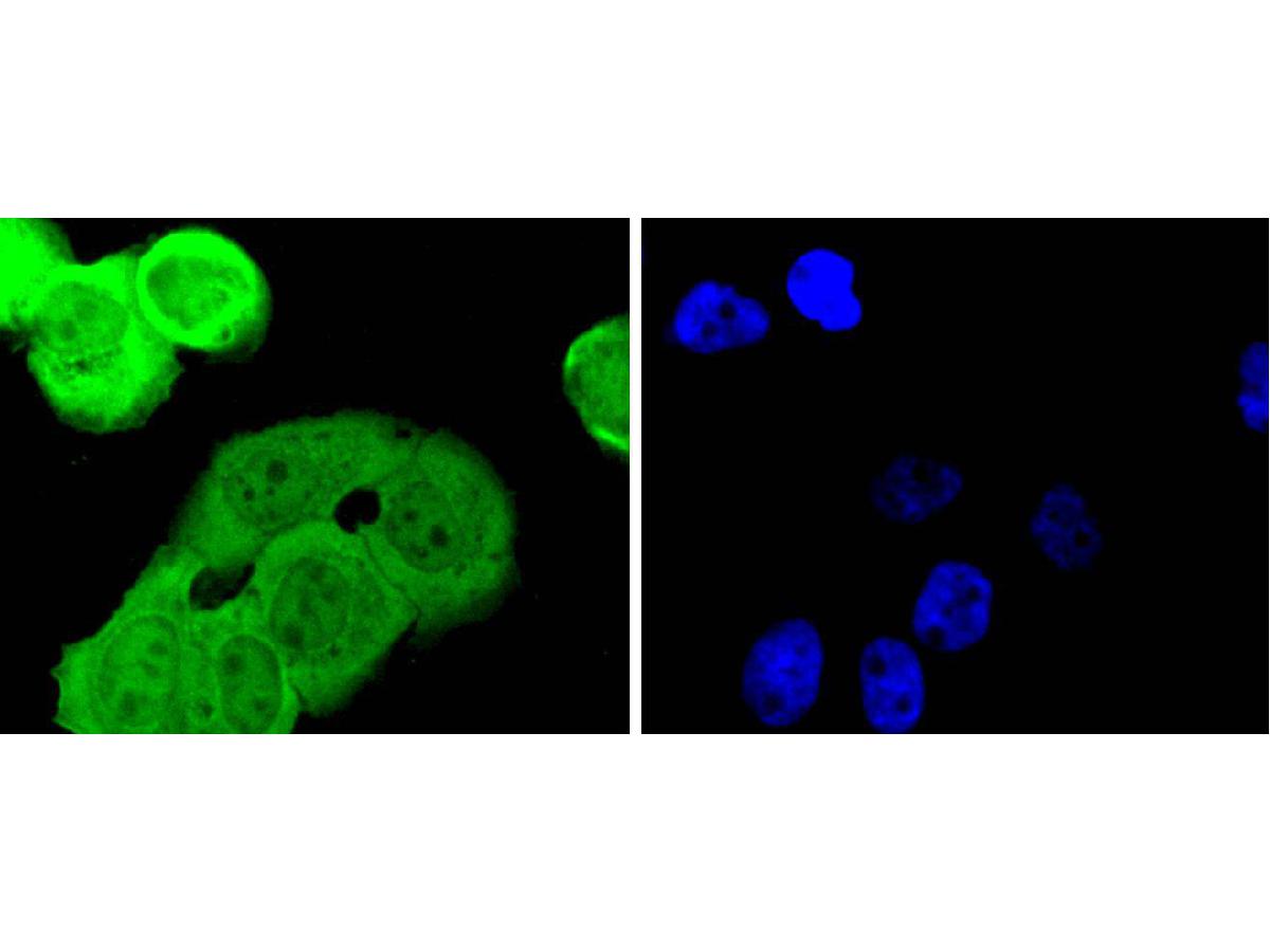 ICC staining of Smad1 in A431 cells (green). Formalin fixed cells were permeabilized with 0.1% Triton X-100 in TBS for 10 minutes at room temperature and blocked with 10% negative goat serum for 15 minutes at room temperature. Cells were probed with the primary antibody (ET1612-39, 1/50) for 1 hour at room temperature, washed with PBS. Alexa Fluor®488 conjugate-Goat anti-Rabbit IgG was used as the secondary antibody at 1/1,000 dilution. The nuclear counter stain is DAPI (blue).