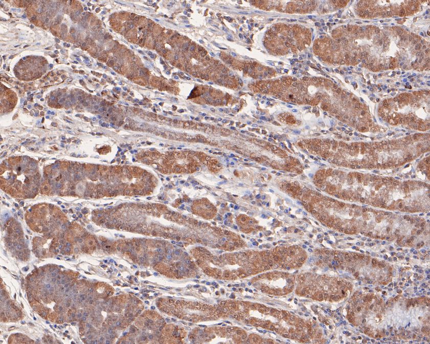 Immunohistochemical analysis of paraffin-embedded human stomach tissue using anti-Smad1 antibody. The section was pre-treated using heat mediated antigen retrieval with sodium citrate buffer (pH 6.0) for 20 minutes. The tissues were blocked in 1% BSA for 30 minutes at room temperature, washed with ddH2O and PBS, and then probed with the primary antibody (ET1612-39, 1/50)  for 30 minutes at room temperature. The detection was performed using an HRP conjugated compact polymer system. DAB was used as the chromogen. Tissues were counterstained with hematoxylin and mounted with DPX.