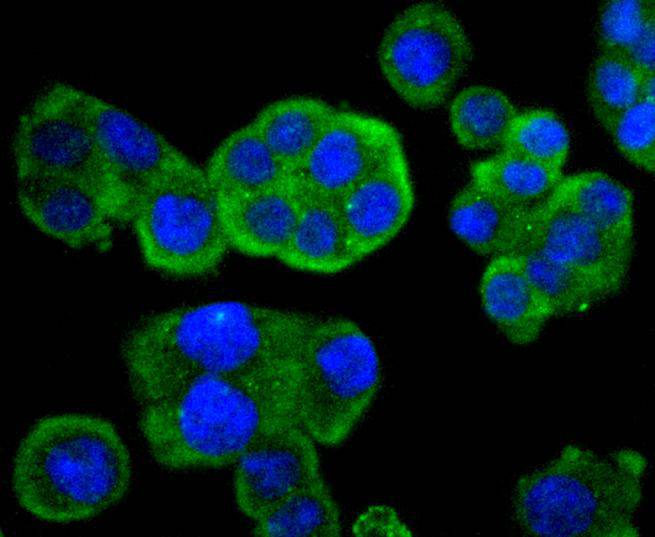 ICC staining of Phospho-MEK1 (S298) in SW480 cells (green). Formalin fixed cells were permeabilized with 0.1% Triton X-100 in TBS for 10 minutes at room temperature and blocked with 1% Blocker BSA for 15 minutes at room temperature. Cells were probed with the primary antibody (ET1612-40, 1/50) for 1 hour at room temperature, washed with PBS. Alexa Fluor®488 Goat anti-Rabbit IgG was used as the secondary antibody at 1/1,000 dilution. The nuclear counter stain is DAPI (blue).