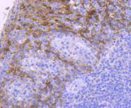 Immunohistochemical analysis of paraffin-embedded human tonsil tissue using anti-14-3-3 sigma antibody. The section was pre-treated using heat mediated antigen retrieval with Tris-EDTA buffer (pH 8.0-8.4) for 20 minutes.The tissues were blocked in 5% BSA for 30 minutes at room temperature, washed with ddH2O and PBS, and then probed with the primary antibody (ET1612-41, 1/50) for 30 minutes at room temperature. The detection was performed using an HRP conjugated compact polymer system. DAB was used as the chromogen. Tissues were counterstained with hematoxylin and mounted with DPX.