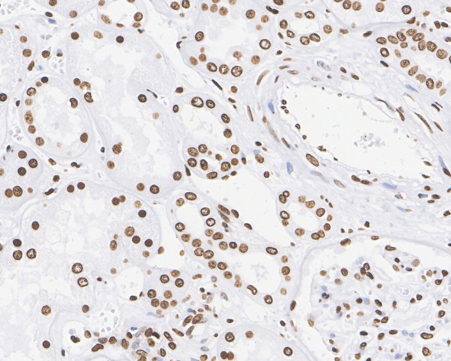 ICC staining of Histone H4 in PANC-1 cells (green). Formalin fixed cells were permeabilized with 0.1% Triton X-100 in TBS for 10 minutes at room temperature and blocked with 1% Blocker BSA for 15 minutes at room temperature. Cells were probed with the primary antibody (ET1612-43, 1/50) for 1 hour at room temperature, washed with PBS. Alexa Fluor®488 Goat anti-Rabbit IgG was used as the secondary antibody at 1/1,000 dilution. The nuclear counter stain is DAPI (blue).