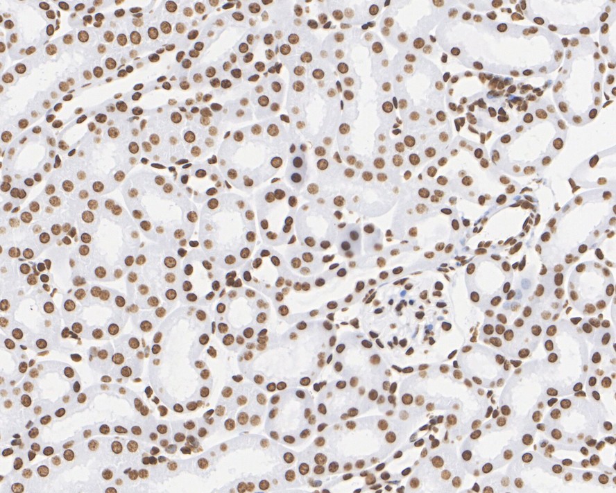 Immunohistochemical analysis of paraffin-embedded human kidney tissue with Rabbit anti-Histone H4 antibody (ET1612-43) at 1/5,000 dilution.<br />
<br />
The section was pre-treated using heat mediated antigen retrieval with sodium citrate buffer (pH 6.0) for 2 minutes. The tissues were blocked in 1% BSA for 20 minutes at room temperature, washed with ddH2O and PBS, and then probed with the primary antibody (ET1612-43) at 1/5,000 dilution for 1 hour at room temperature. The detection was performed using an HRP conjugated compact polymer system. DAB was used as the chromogen. Tissues were counterstained with hematoxylin and mounted with DPX.