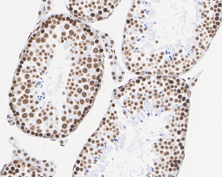 Immunohistochemical analysis of paraffin-embedded human kidney tissue with Rabbit anti-Histone H4 antibody (ET1612-43) at 1/5,000 dilution.<br />
<br />
The section was pre-treated using heat mediated antigen retrieval with sodium citrate buffer (pH 6.0) for 2 minutes. The tissues were blocked in 1% BSA for 20 minutes at room temperature, washed with ddH2O and PBS, and then probed with the primary antibody (ET1612-43) at 1/5,000 dilution for 1 hour at room temperature. The detection was performed using an HRP conjugated compact polymer system. DAB was used as the chromogen. Tissues were counterstained with hematoxylin and mounted with DPX.