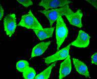 ICC staining of Tau in SH-SY5Y cells (green). Formalin fixed cells were permeabilized with 0.1% Triton X-100 in TBS for 10 minutes at room temperature and blocked with 1% Blocker BSA for 15 minutes at room temperature. Cells were probed with the primary antibody (ET1612-44, 1/50) for 1 hour at room temperature, washed with PBS. Alexa Fluor®488 Goat anti-Rabbit IgG was used as the secondary antibody at 1/1,000 dilution. The nuclear counter stain is DAPI (blue).