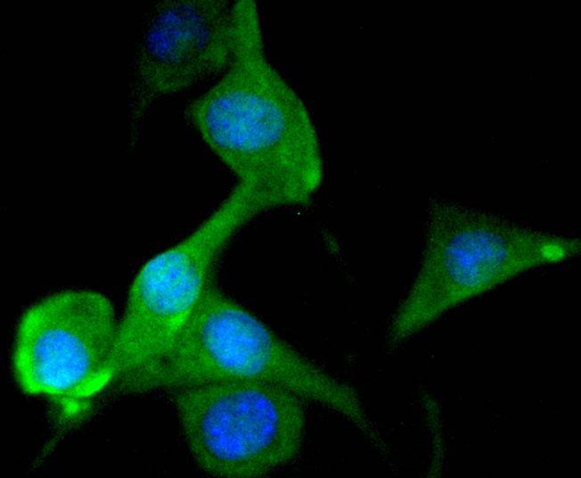 ICC staining of Tau in SHG-44 cells (green). Formalin fixed cells were permeabilized with 0.1% Triton X-100 in TBS for 10 minutes at room temperature and blocked with 1% Blocker BSA for 15 minutes at room temperature. Cells were probed with the primary antibody (ET1612-44, 1/50) for 1 hour at room temperature, washed with PBS. Alexa Fluor®488 Goat anti-Rabbit IgG was used as the secondary antibody at 1/1,000 dilution. The nuclear counter stain is DAPI (blue).