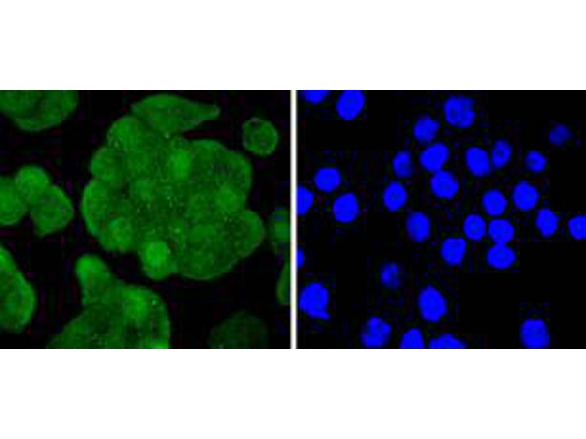 ICC staining of IRS1 in SW480 cells (green). Formalin fixed cells were permeabilized with 0.1% Triton X-100 in TBS for 10 minutes at room temperature and blocked with 1% Blocker BSA for 15 minutes at room temperature. Cells were probed with the primary antibody (ET1612-45, 1/50) for 1 hour at room temperature, washed with PBS. Alexa Fluor®488 Goat anti-Rabbit IgG was used as the secondary antibody at 1/1,000 dilution. The nuclear counter stain is DAPI (blue).