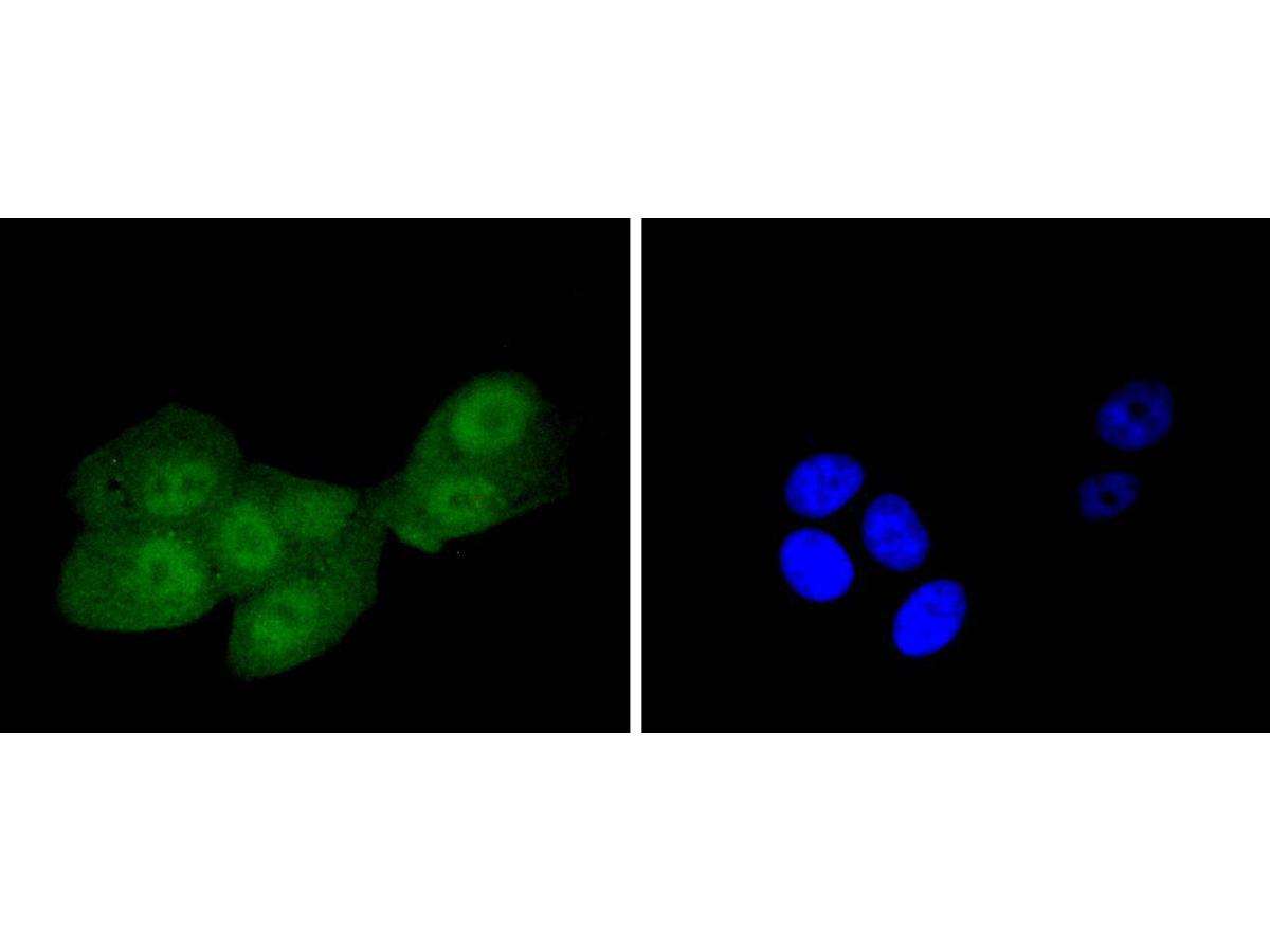 ICC staining of IRS1 in MCF-7 cells (green). Formalin fixed cells were permeabilized with 0.1% Triton X-100 in TBS for 10 minutes at room temperature and blocked with 1% Blocker BSA for 15 minutes at room temperature. Cells were probed with the primary antibody (ET1612-45, 1/50) for 1 hour at room temperature, washed with PBS. Alexa Fluor®488 Goat anti-Rabbit IgG was used as the secondary antibody at 1/1,000 dilution. The nuclear counter stain is DAPI (blue).