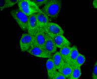 ICC staining Angiotensinogen in HepG2 cells (green). The nuclear counter stain is DAPI (blue). Cells were fixed in paraformaldehyde, permeabilised with 0.25% Triton X100/PBS.