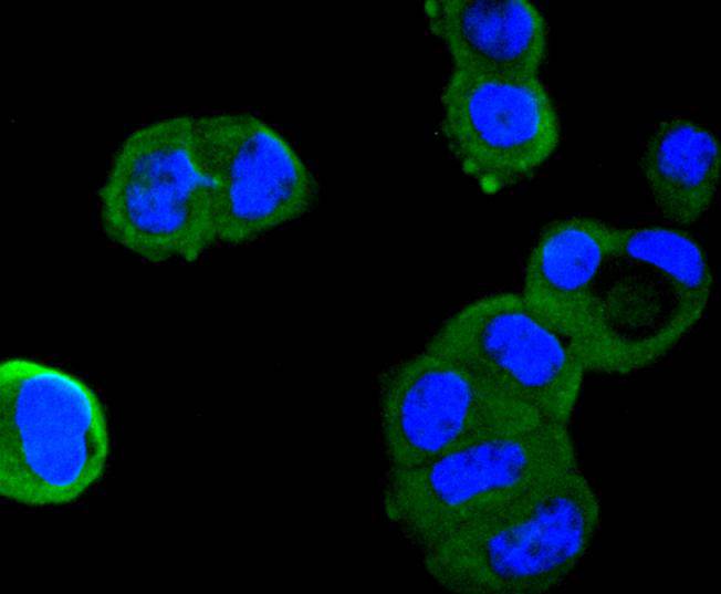 ICC staining Angiotensinogen in LO2 cells (green). The nuclear counter stain is DAPI (blue). Cells were fixed in paraformaldehyde, permeabilised with 0.25% Triton X100/PBS.