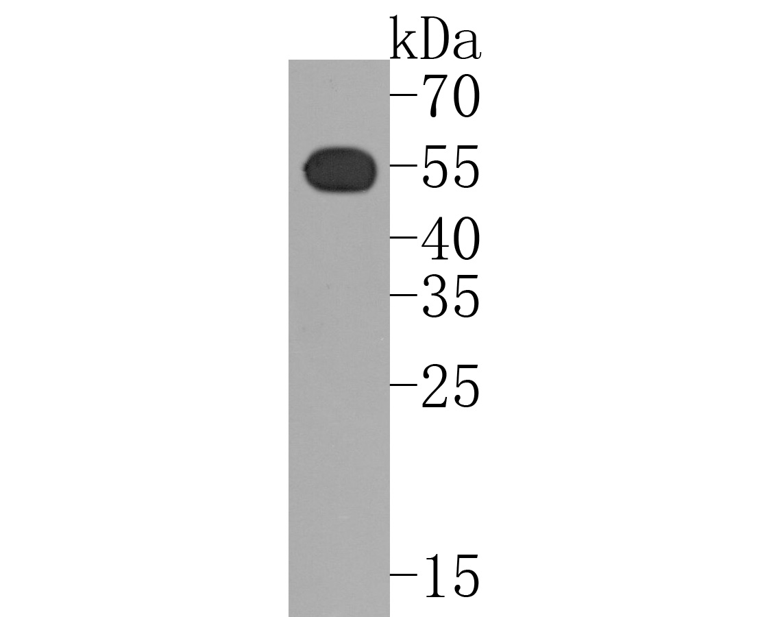 Western blot analysis of TRAF2 on SK-Br-3 cell lysates. Proteins were transferred to a PVDF membrane and blocked with 5% BSA in PBS for 1 hour at room temperature. The primary antibody (ET1612-5, 1/500) was used in 5% BSA at room temperature for 2 hours. Goat Anti-Rabbit IgG - HRP Secondary Antibody (HA1001) at 1:5,000 dilution was used for 1 hour at room temperature.