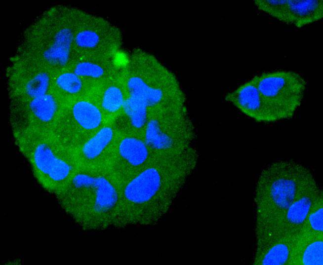 ICC staining of TRAF2 in RH-35 cells (green). Formalin fixed cells were permeabilized with 0.1% Triton X-100 in TBS for 10 minutes at room temperature and blocked with 1% Blocker BSA for 15 minutes at room temperature. Cells were probed with the primary antibody (ET1612-5, 1/50) for 1 hour at room temperature, washed with PBS. Alexa Fluor®488 Goat anti-Rabbit IgG was used as the secondary antibody at 1/1,000 dilution. The nuclear counter stain is DAPI (blue).
