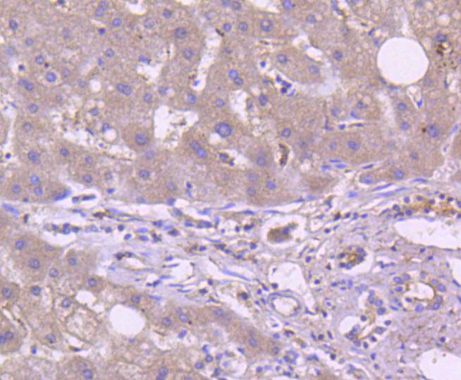 Immunohistochemical analysis of paraffin-embedded human liver tissue using anti-TRAF2 antibody. The section was pre-treated using heat mediated antigen retrieval with Tris-EDTA buffer (pH 8.0-8.4) for 20 minutes.The tissues were blocked in 5% BSA for 30 minutes at room temperature, washed with ddH2O and PBS, and then probed with the primary antibody (ET1612-5, 1/50) for 30 minutes at room temperature. The detection was performed using an HRP conjugated compact polymer system. DAB was used as the chromogen. Tissues were counterstained with hematoxylin and mounted with DPX.