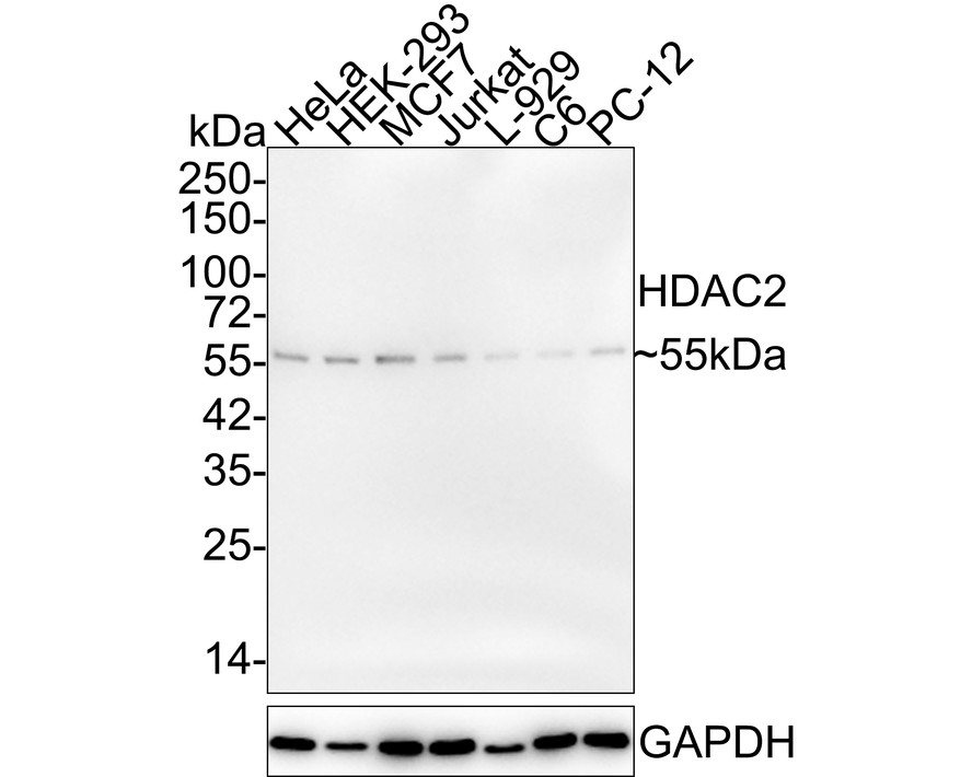 Western blot analysis of HDAC2 on different lysates. Proteins were transferred to a PVDF membrane and blocked with 5% BSA in PBS for 1 hour at room temperature. The primary antibody (ET1612-50, 1/500) was used in 5% BSA at room temperature for 2 hours. Goat Anti-Rabbit IgG - HRP Secondary Antibody (HA1001) at 1:200,000 dilution was used for 1 hour at room temperature.<br />
Positive control: <br />
Lane 1: Hela cell lysate<br />
Lane 2: K562 cell lysate<br />
<br />
Predicted band size: 55 kDa<br />
Observed band size: 60 kDa
