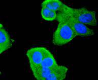 ICC staining of HDAC4 in Hela cells (green). Formalin fixed cells were permeabilized with 0.1% Triton X-100 in TBS for 10 minutes at room temperature and blocked with 10% negative goat serum for 15 minutes at room temperature. Cells were probed with the primary antibody (ET1612-51, 1/50) for 1 hour at room temperature, washed with PBS. Alexa Fluor®488 conjugate-Goat anti-Rabbit IgG was used as the secondary antibody at 1/1,000 dilution. The nuclear counter stain is DAPI (blue).
