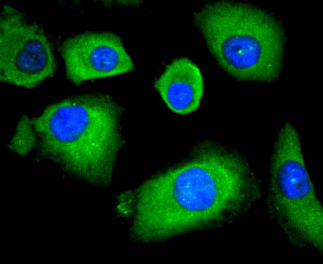 ICC staining of HDAC4 in A549 cells (green). Formalin fixed cells were permeabilized with 0.1% Triton X-100 in TBS for 10 minutes at room temperature and blocked with 10% negative goat serum for 15 minutes at room temperature. Cells were probed with the primary antibody (ET1612-51, 1/50) for 1 hour at room temperature, washed with PBS. Alexa Fluor®488 conjugate-Goat anti-Rabbit IgG was used as the secondary antibody at 1/1,000 dilution. The nuclear counter stain is DAPI (blue).