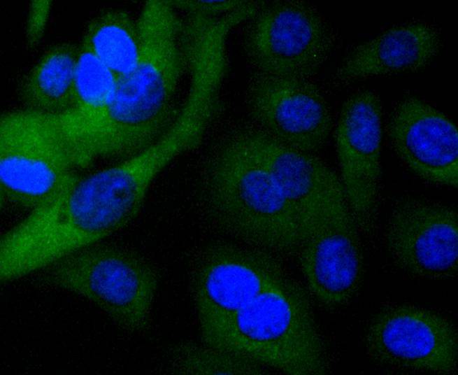 ICC staining of TRK fused gene in SKOV-3 cells (green). Formalin fixed cells were permeabilized with 0.1% Triton X-100 in TBS for 10 minutes at room temperature and blocked with 1% Blocker BSA for 15 minutes at room temperature. Cells were probed with the primary antibody (ET1612-52, 1/50) for 1 hour at room temperature, washed with PBS. Alexa Fluor®488 Goat anti-Rabbit IgG was used as the secondary antibody at 1/1,000 dilution. The nuclear counter stain is DAPI (blue).