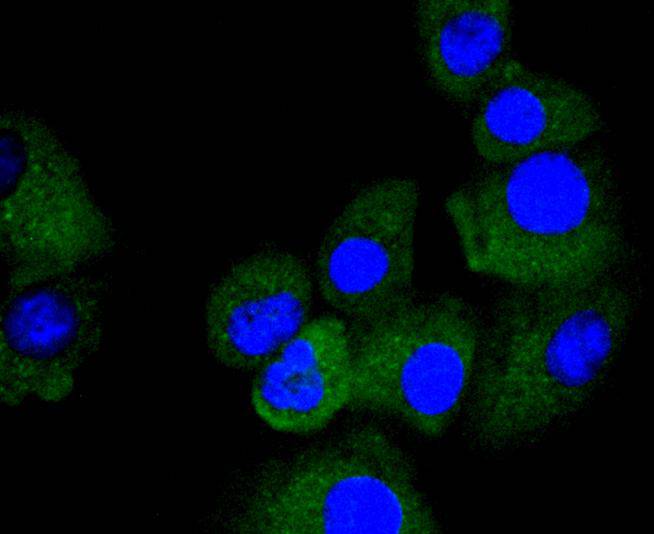 ICC staining of TRK fused gene in A549 cells (green). Formalin fixed cells were permeabilized with 0.1% Triton X-100 in TBS for 10 minutes at room temperature and blocked with 1% Blocker BSA for 15 minutes at room temperature. Cells were probed with the primary antibody (ET1612-52, 1/50) for 1 hour at room temperature, washed with PBS. Alexa Fluor®488 Goat anti-Rabbit IgG was used as the secondary antibody at 1/1,000 dilution. The nuclear counter stain is DAPI (blue).