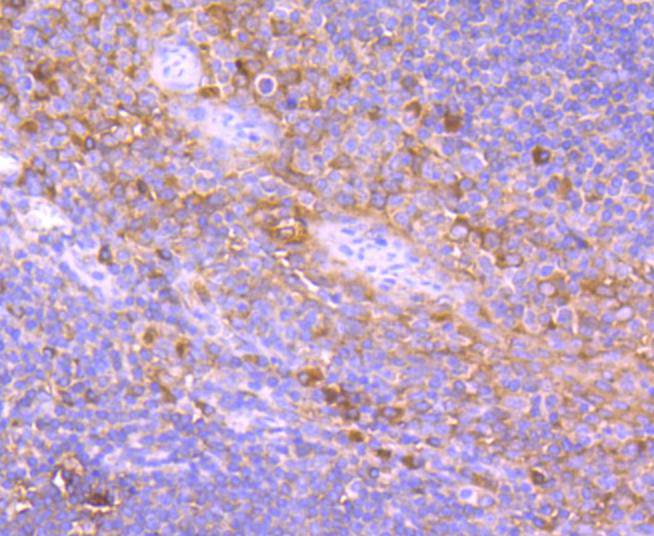Immunohistochemical analysis of paraffin-embedded human tonsil tissue using anti-TRK fused gene antibody. The section was pre-treated using heat mediated antigen retrieval with Tris-EDTA buffer (pH 8.0-8.4) for 20 minutes.The tissues were blocked in 5% BSA for 30 minutes at room temperature, washed with ddH2O and PBS, and then probed with the primary antibody (ET1612-52, 1/50) for 30 minutes at room temperature. The detection was performed using an HRP conjugated compact polymer system. DAB was used as the chromogen. Tissues were counterstained with hematoxylin and mounted with DPX.