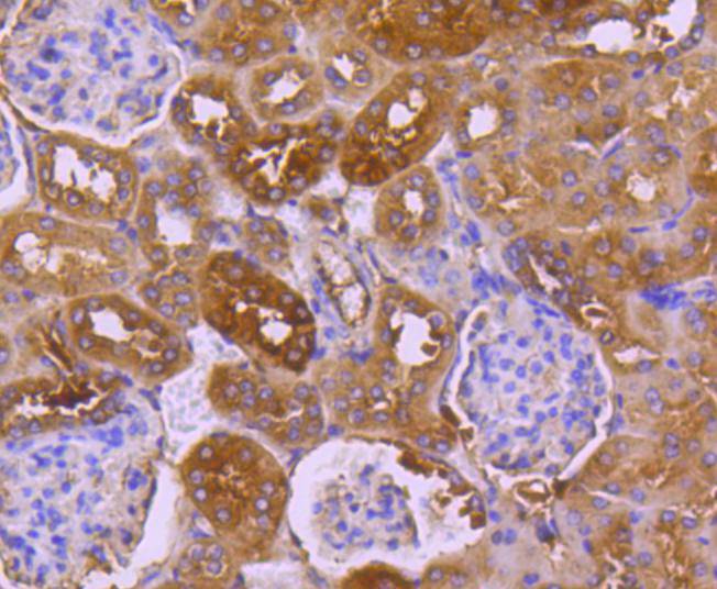 Immunohistochemical analysis of paraffin-embedded mouse kidney tissue using anti-TRK fused gene antibody. The section was pre-treated using heat mediated antigen retrieval with Tris-EDTA buffer (pH 8.0-8.4) for 20 minutes.The tissues were blocked in 5% BSA for 30 minutes at room temperature, washed with ddH2O and PBS, and then probed with the primary antibody (ET1612-52, 1/50) for 30 minutes at room temperature. The detection was performed using an HRP conjugated compact polymer system. DAB was used as the chromogen. Tissues were counterstained with hematoxylin and mounted with DPX.