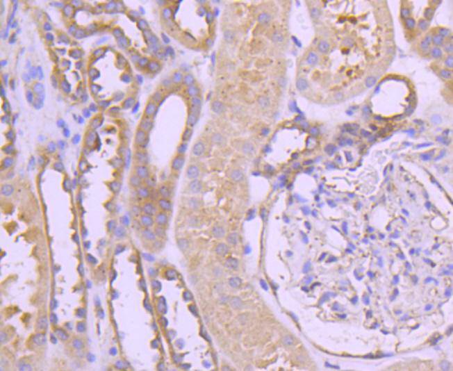 Immunohistochemical analysis of paraffin-embedded human kidney tissue using anti-TRK fused gene antibody. The section was pre-treated using heat mediated antigen retrieval with Tris-EDTA buffer (pH 8.0-8.4) for 20 minutes.The tissues were blocked in 5% BSA for 30 minutes at room temperature, washed with ddH2O and PBS, and then probed with the primary antibody (ET1612-52, 1/50) for 30 minutes at room temperature. The detection was performed using an HRP conjugated compact polymer system. DAB was used as the chromogen. Tissues were counterstained with hematoxylin and mounted with DPX.